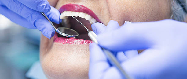 Best Emergency Treatment for Dental Infections or Abscesses in Lamar, SC